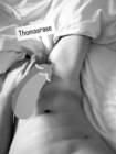 Thomasrase