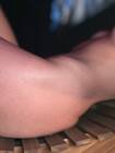LK