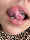 Allana