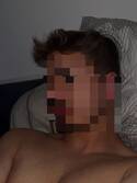 Lokote