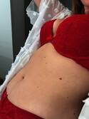 Aline