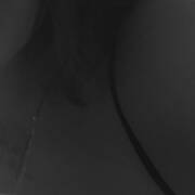 Cilla