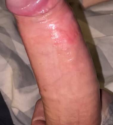 Bgdk