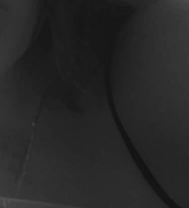 Cilla