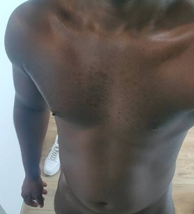 FRANCK