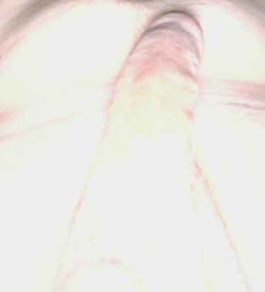 Enzo