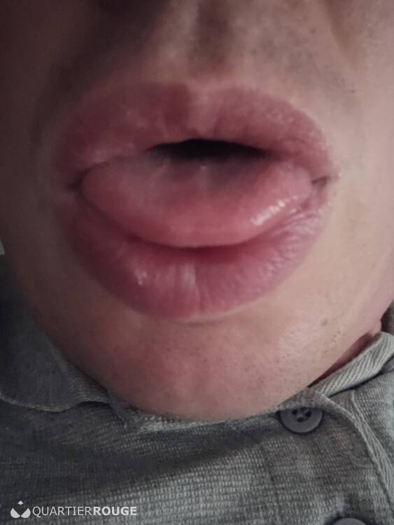 Priv&eacute; Sébastien