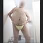 Romuald zincks (Photo #1)
