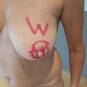VAGINELLA (Photo #96)